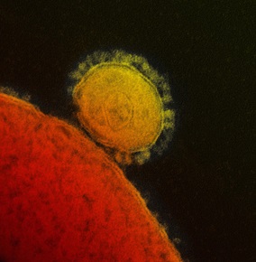 الفيروس التاجي المسبب لمتلازمة الشرق الأوسط التنفسية